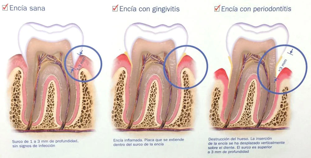 Clínica Dental Reyes Flamarique esquema dental